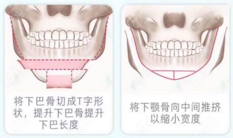 风水堂：骨有九起